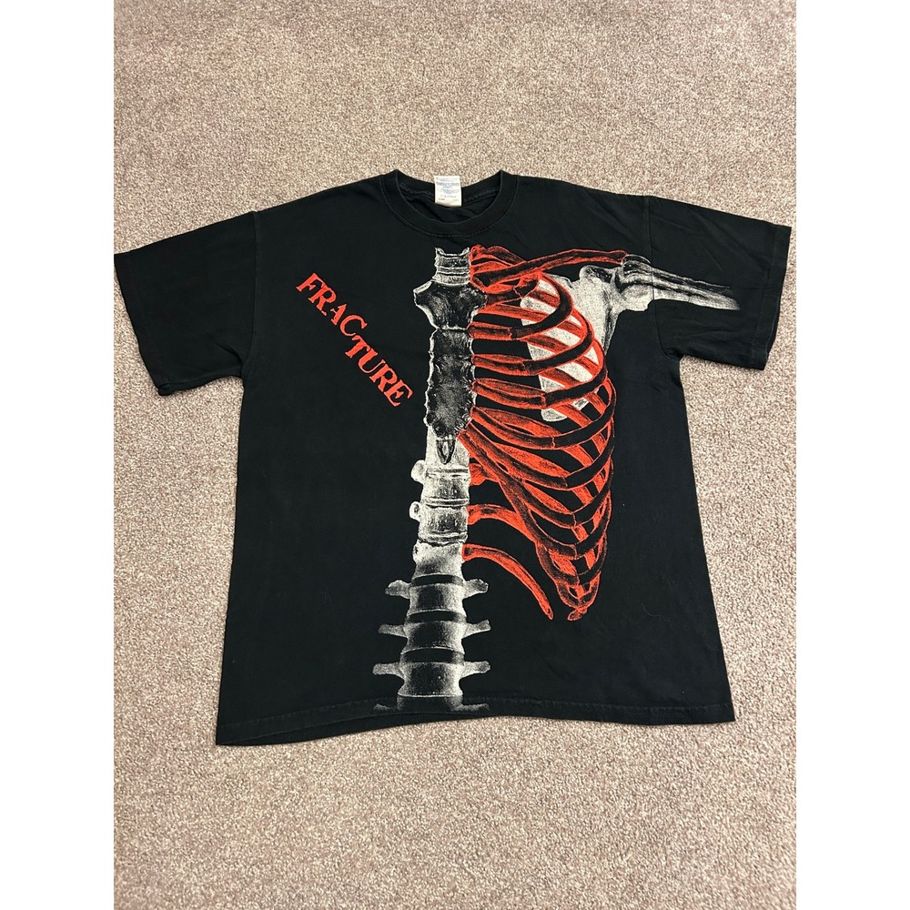 Fracture Skeleton Graphic T-Shirt Mens Medium Black Excellent Ribcage Tee
